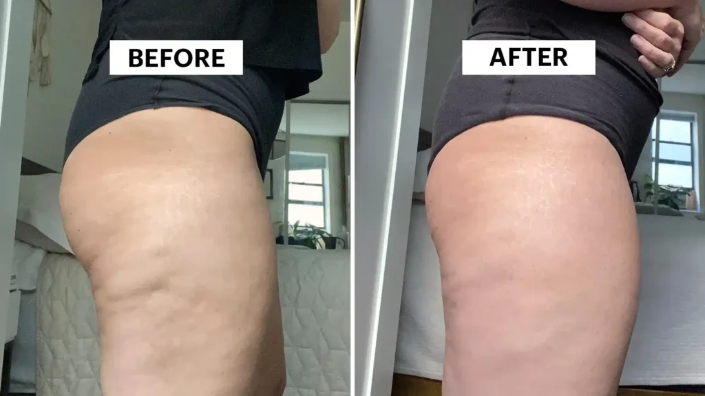 Sculpting Your Bum: Can Toning Exercises Really Reduce Cellulite? 1 Do Toning Exercise Rochester Really Tackle Cellulite?
